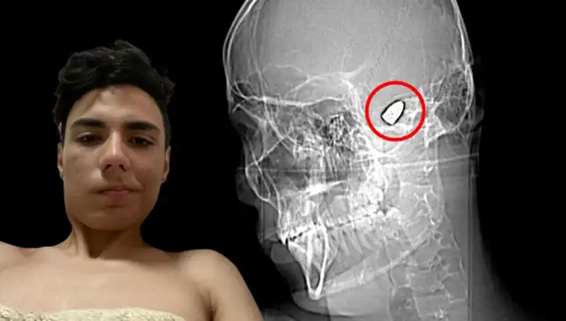Hayatına Patlayan Bir Bomba ile Devam Eden İnsan: Gerçek Hikaye