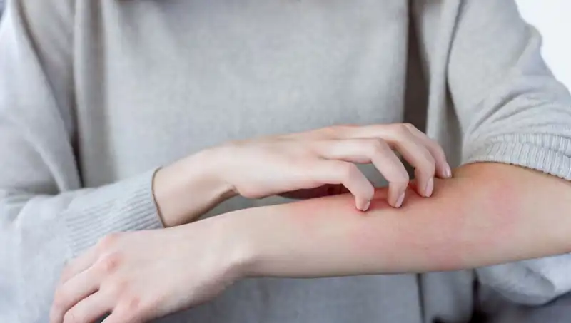 Cilt Kanserinin Gizli Belirtileri: Dermatologdan İpuçları